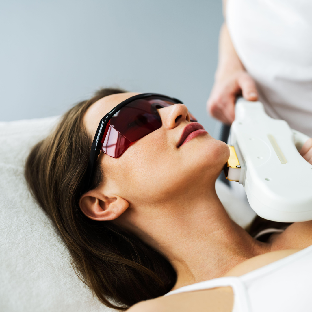 IPL for Face or Decolette